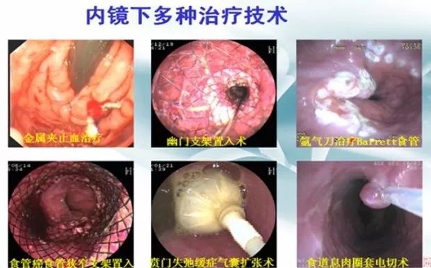 最新胃肠镜医生招聘，专业人才迫切需求与未来展望